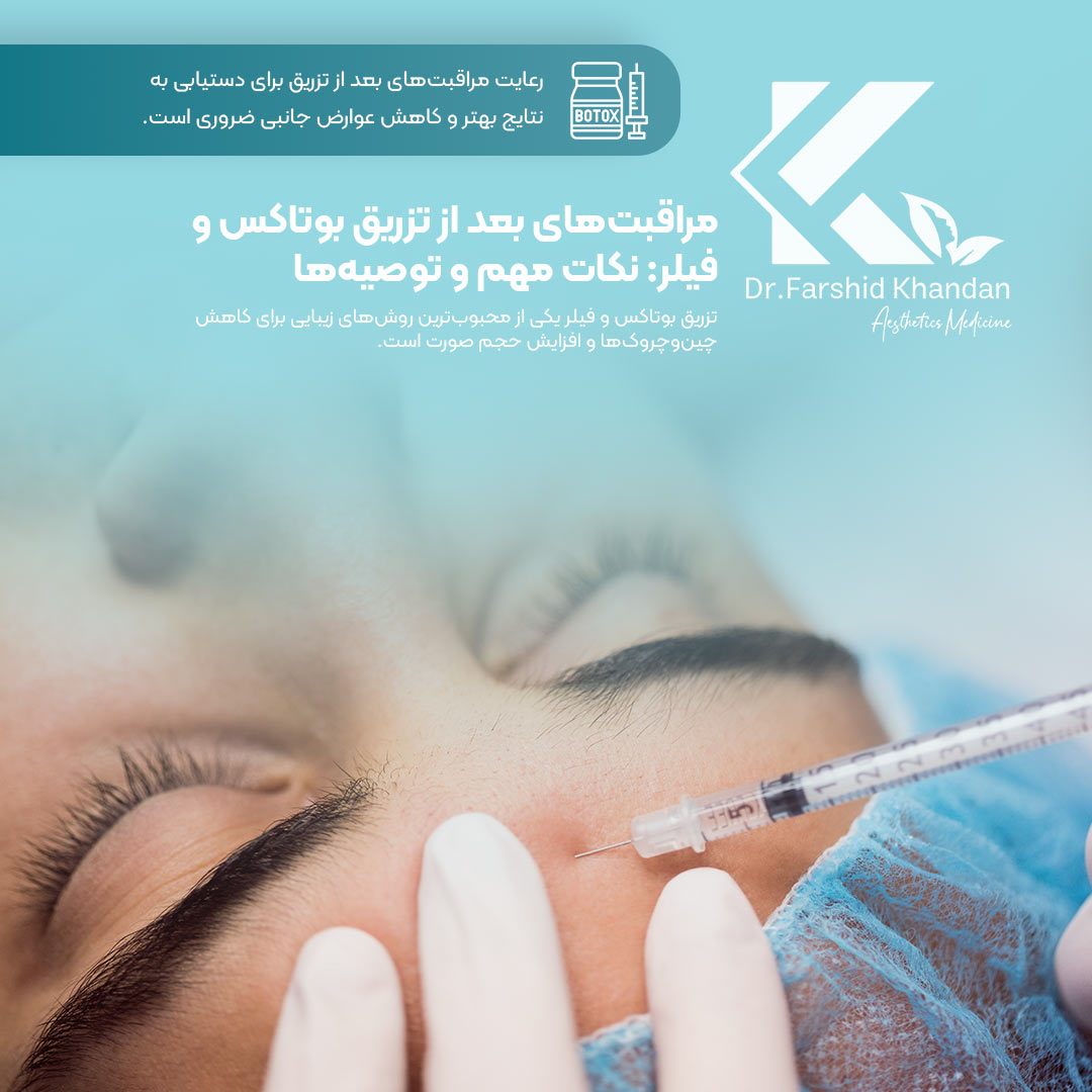 مراقبت‌های بعد از تزریق بوتاکس و فیلر: نکات مهم و توصیه‌ها